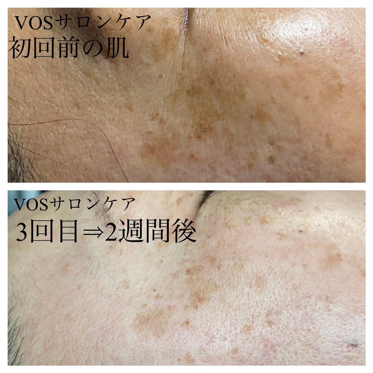 乾燥によるくすみ